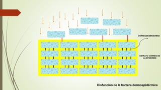 Disfunción de la barrera dermoepidérmica
ESTRATO CÓRNEO DE
LA EPIDERMIS
CORNEODESMOSOMAS
 