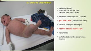 EL CASO DE CRISTOPHER
 1 AÑO DE EDAD
 ECCEMA PRURIGINOSO,
EXUDATIVO, UNIVERSAL
 3 Eventos de bronquiolitis (¿Asma?
 IgE: 2950 UI/ml ( valor normal < 60)
 Pruebas serologica de Alergia:
 Positiva a leche, huevo, soya
 Polifarmacia
 Múltiples tratamientos con diversos
médicos
 