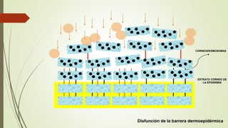 Disfunción de la barrera dermoepidérmica
ESTRATO CÓRNEO DE
LA EPIDERMIS
CORNEODESMOSOMAS
 