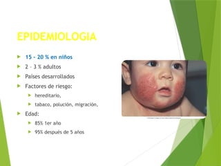 EPIDEMIOLOGIA
 15 – 20 % en niños
 2 – 3 % adultos
 Países desarrollados
 Factores de riesgo:
 hereditario,
 tabaco, polución, migración,
 Edad:
 85% 1er año
 95% después de 5 años
 