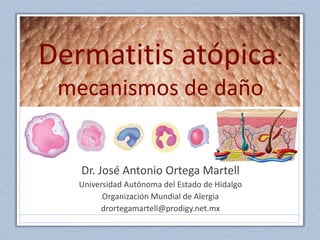 Dermatitis atópica:
mecanismos de daño
Dr. José Antonio Ortega Martell
Universidad Autónoma del Estado de Hidalgo
Organización Mundial de Alergia
drortegamartell@prodigy.net.mx
 