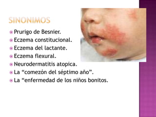  Prurigode Besnier.
 Eczema constitucional.
 Eczema del lactante.
 Eczema flexural.
 Neurodermatitis atopica.
 La ―comezón del séptimo año‖.
 La ―enfermedad de los niños bonitos.
 