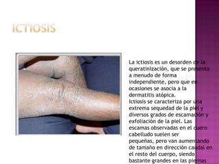 La ictiosis es un desorden de la
queratinización, que se presenta
a menudo de forma
independiente, pero que en
ocasiones se asocia a la
dermatitis atópica.
Ictiosis se caracteriza por una
extrema sequedad de la piel y
diversos grados de escamación y
exfoliación de la piel. Las
escamas observadas en el cuero
cabelludo suelen ser
pequeñas, pero van aumentando
de tamaño en dirección caudal en
el resto del cuerpo, siendo
bastante grandes en las piernas
 