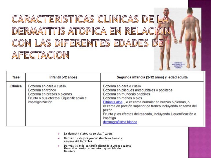 El tratamiento de la psoriasis sanatorno