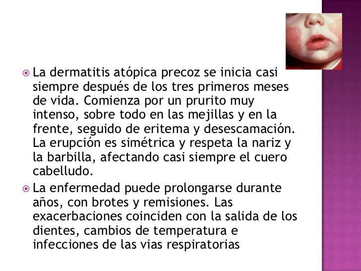 Como beber correctamente la celidonia mayor a la psoriasis