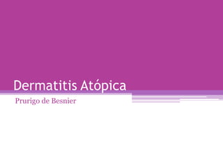 Dermatitis Atópica
Prurigo de Besnier
 