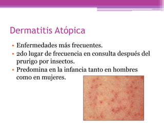 Dermatitis Atópica
• Enfermedades más frecuentes.
• 2do lugar de frecuencia en consulta después del
  prurigo por insectos.
• Predomina en la infancia tanto en hombres
  como en mujeres.
 