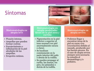 Síntomas

                            Sintomatología en
  Sintomatología en          atopia moderada:            Sintomatología en
      atopia leve          áreas de la piel seca y         atopia severa
                                  curtida
• Picazón intensa.         • Pigmentación en la piel   • Podemos llegar a
• Ampollas que pueden        inferior o superior al      encontrar áreas de la
  formar costras.            tono normal (ver piel       piel en carne viva
• Enrojecimiento o           anormalmente oscura         (excoriación) debido al
  inflamación de la piel     o clara).                   rascado, producido por
  alrededor de las         • Se localizan                los fuertes picores. En
  ampollas.                  comúnmente en la            el caso de atopia severa
                             parte interior del codo     siempre será necesaria
• Erupción cutánea.
                             o detrás de la rodilla.     la consulta al
                           • Se pueden propagar al       dermatólogo y/o
                             cuello, las manos, los      pediatra.
                             pies, los párpados o
                             detrás de la rodilla.
 