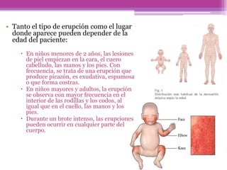 • Tanto el tipo de erupción como el lugar
  donde aparece pueden depender de la
  edad del paciente:
     En niños menores de 2 años, las lesiones
      de piel empiezan en la cara, el cuero
      cabelludo, las manos y los pies. Con
      frecuencia, se trata de una erupción que
      produce picazón, es exudativa, espumosa
      o que forma costras.
     En niños mayores y adultos, la erupción
      se observa con mayor frecuencia en el
      interior de las rodillas y los codos, al
      igual que en el cuello, las manos y los
      pies.
     Durante un brote intenso, las erupciones
      pueden ocurrir en cualquier parte del
      cuerpo.
 