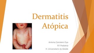 Dermatitis
Atópica
Antonia Carretero Oya
R1 Pediatría
H. Universitario de Getafe
 