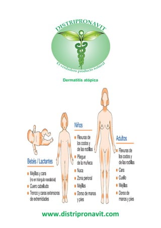 www.distripronavit.com
Dermatitis atópica
 