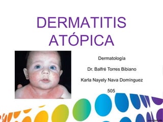 DERMATITIS
ATÓPICA
Dermatología
Dr. Balfré Torres Bibiano
Karla Nayely Nava Domínguez
505

 