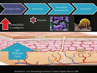 •pH
•Proteasas
•Agua
Enzimas
Permeabilida
d a antígenos
Eichenfield L. et al. Dermatologia neonatal. 2ª edición. España: Elsevier: 2009
Filagrina
-
Fenotipo cutáneo Inmunología
Desequilibrio
Neurovegetativo
Personalidad
 