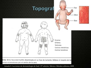 Amado S. Lecciones de dermatología de Saúl. 15ª edición. México: Méndez editores; 2008
 
