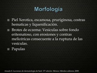  Piel Xerotica, escamosa, pruriginosa, costras
hematicas y liquenificación.
 Brotes de eczema: Vesiculas sobre fondo
eritematoso, con erosiones y contras
melicéricas consecuente a la ruptura de las
vesículas.
 Papulas
Amado S. Lecciones de dermatología de Saúl. 15ª edición. México: Méndez editores; 2008
 
