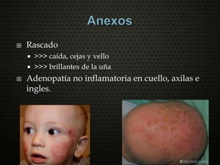  Rascado
 >>> caída, cejas y vello
 >>> brillantes de la uña
 Adenopatía no inflamatoria en cuello, axilas e
ingles.
 