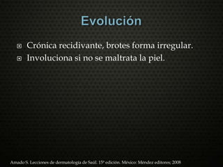  Crónica recidivante, brotes forma irregular.
 Involuciona si no se maltrata la piel.
Amado S. Lecciones de dermatología de Saúl. 15ª edición. México: Méndez editores; 2008
 