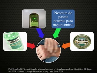 Necesita de
pastas
neutras para
mejor control
Wolff K.,Allen R. Fitzpatrick’s color atlas and synopsis of clinical dermatology. 6th edition. Mc Graw
Hill; 2009. Williams H. Atopic Dermatitis. n engl j med ;June: 2005
 