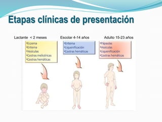 Etapas clínicas de presentación 
Lactante < 2 meses Escolar 4-14 años Adulto 15-23 años 
 