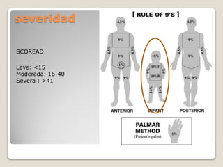 SCOREAD
Leve: <15
Moderada: 16-40
Severa : >41
severidad
 