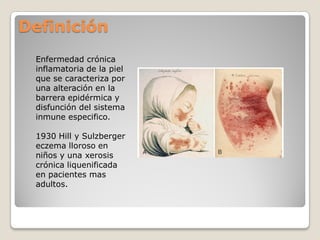 Definición
Enfermedad crónica
inflamatoria de la piel
que se caracteriza por
una alteración en la
barrera epidérmica y
disfunción del sistema
inmune especifico.
1930 Hill y Sulzberger
eczema lloroso en
niños y una xerosis
crónica liquenificada
en pacientes mas
adultos.
 