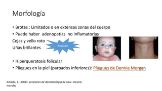 Morfología
• Brotes : Limitados o en extensas zonas del cuerpo
• Puede haber adenopatías no inflamatorias
Cejas y vello roto
Uñas brillantes
• Hiperqueratosis folicular
• Pliegues en la piel (parpados inferiores): Pliegues de Dennie Morgan
Rascado
Amado, S. (2008). Lecciones de dermatologia de saul. mexico:
mendez
 