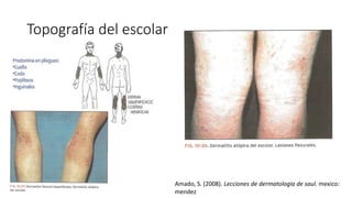 Topografía del escolar
Amado, S. (2008). Lecciones de dermatologia de saul. mexico:
mendez
 