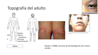 Topografía del adulto
Adulto Amado, S. (2008). Lecciones de dermatologia de saul. mexico:
mendez
 