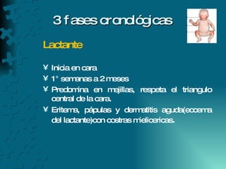3 fases cronológicas  Lactante Inicia en cara  1° semanas a 2 meses  Predomina en mejillas, respeta el triangulo central de la cara. Eritema, pápulas y dermatitis aguda(eccema del lactante)con costras mielicericas . 