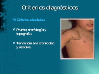 Criterios diagnósticos A) Criterios absolutos: Prurito; morfología y topografía Tendencia a la cronicidad  y recidiva. 