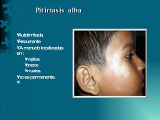 Pitiriasis alba  Autolimitada  Recurrente  A menudo localizadas en : mejillas  brazos  muslos. no es permanente.   