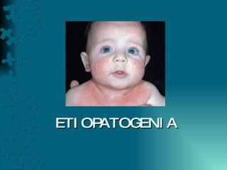 ETIOPATOGENIA 
