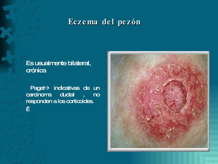 CPHAP 024 Dermatitis Atopica CPHAP 024 Dermatitis Atopica