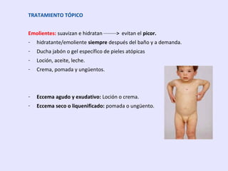TRATAMIENTO TÓPICO
Emolientes: suavizan e hidratan evitan el picor.
- hidratante/emoliente siempre después del baño y a demanda.
- Ducha jabón o gel específico de pieles atópicas
- Loción, aceite, leche.
- Crema, pomada y ungüentos.
- Eccema agudo y exudativo: Loción o crema.
- Eccema seco o liquenificado: pomada o ungüento.
 