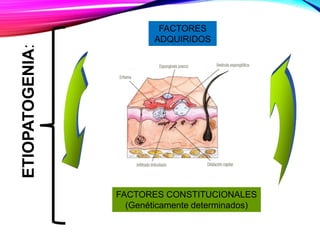 ETIOPATOGENIA: FACTORES
ADQUIRIDOS
FACTORES CONSTITUCIONALES
(Genéticamente determinados)
 
