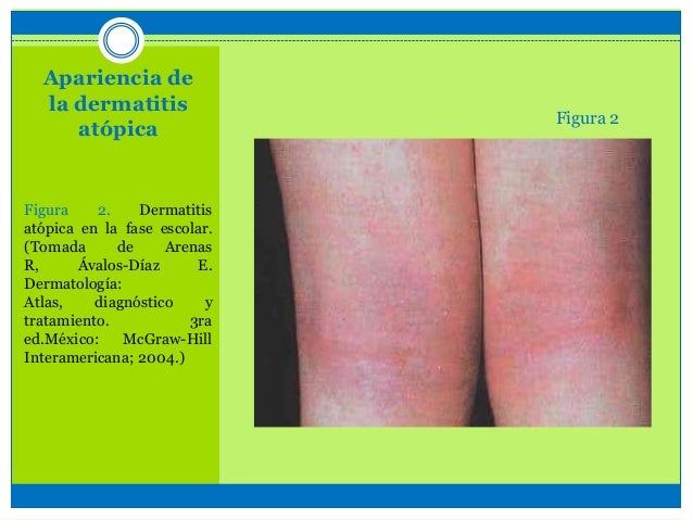 Que órganos limpiar a la psoriasis