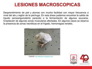 LESIONES MACROSCOPICAS
Desprendimiento de piel y plumas con mucha facilidad con mayor frecuencia a
nivel del ala y región de la pechuga. En esta áreas podemos encontrar la salida de
líquido serosanguinolento parecido a la fermentación de algunos azucares.
Crepitación de algunas zonas musculares afectadas. En algunos casos se observa
la presencia de zonas necróticas en el hígado, hemorragias renales.
FUENTE: dermatitisaves.blogspot.com
 