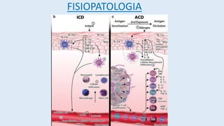 FISIOPATOLOGIA
 