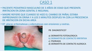 CASO 1
• PACIENTE PEDIATRICO MASCULINO DE 3 AÑOS DE EDAD QUE PRESENTA
IRRITACION EN ZONA GENITAL E INGUINAL
• MADRE REFIERE QUE CUANDO SE HIZO EL CAMBIO DE PAÑAL ESTABA
IMPREGNADO EN ORINA Y A LOS 5 MINUTOS DESPUES YA CON LA PRESCENCIA
DE IRRITACION EN DICHA AREA
• EF: placas eritematosas y edematosas con erosiones y costras.
PB DIAGNOSTICO?
a) DERMATITIS FOTOALERGICA
b) DERMATITIS DE CONTACTO IRRITATIVA
c) PSORIASIS
d) DERMATITIS DE CONTACTO ALERGICA
 