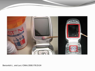 Bercovitch L , and Luo J CMAJ 2008;178:23-24
 