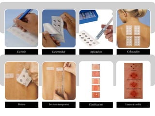 Escribir Desprender Aplicación Colocación
Retiro Lectura temprana Clasificación Lectura tardía
 
