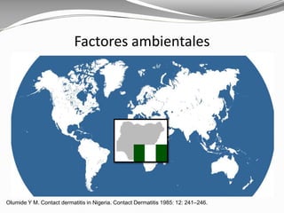 Olumide Y M. Contact dermatitis in Nigeria. Contact Dermatitis 1985: 12: 241–246.
Factores ambientales
 
