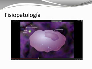 Fisiopatología
 