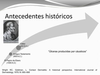 Wright RC, Goldman, L. Contact Dermatitis: A historical perspective. International Journal of
Dermatology, 1979;18: 665–668
Antecedentes históricos
Papiro de Ebers
(1500 A.C)
Antiguo Testamento
(900 A.C.)
Celso
(45 D.C.)
“Úlceras producidas por cáusticos”
 