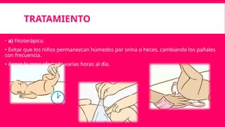 TRATAMIENTO
 a) Fitoterápico.
• Evitar que los niños permanezcan húmedos por orina o heces, cambiando los pañales
con frecuencia.
• Airear la zona afectada varias horas al día.
 