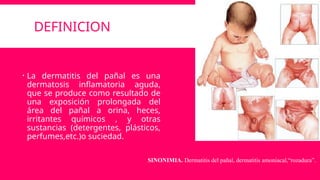 DEFINICION
 La dermatitis del pañal es una
dermatosis inflamatoria aguda,
que se produce como resultado de
una exposición prolongada del
área del pañal a orina, heces,
irritantes químicos , y otras
sustancias (detergentes, plásticos,
perfumes,etc.)o suciedad.
SINONIMIA. Dermatitis del pañal, dermatitis amoniacal,“rozadura”.
 