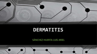DERMATITIS
SÁNCHEZ HUERTA LUIS ARIEL
 