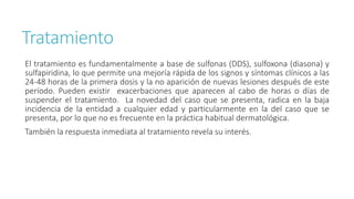 Tratamiento
El tratamiento es fundamentalmente a base de sulfonas (DDS), sulfoxona (diasona) y
sulfapiridina, lo que permite una mejoría rápida de los signos y síntomas clínicos a las
24-48 horas de la primera dosis y la no aparición de nuevas lesiones después de este
período. Pueden existir exacerbaciones que aparecen al cabo de horas o días de
suspender el tratamiento. La novedad del caso que se presenta, radica en la baja
incidencia de la entidad a cualquier edad y particularmente en la del caso que se
presenta, por lo que no es frecuente en la práctica habitual dermatológica.
También la respuesta inmediata al tratamiento revela su interés.
 