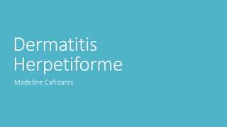 Dermatitis
Herpetiforme
Madeline Cañizares
 