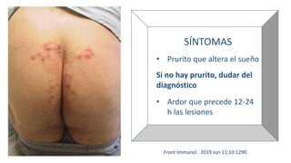 SÍNTOMAS
• Prurito que altera el sueño
Si no hay prurito, dudar del
diagnóstico
• Ardor que precede 12-24
h las lesiones
Front Immunol . 2019 Jun 11;10:1290.
 